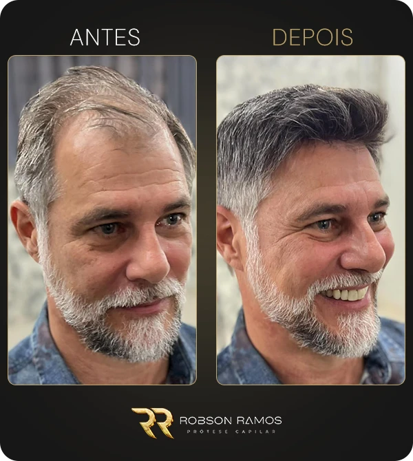 galeria-AD-45a65+-01