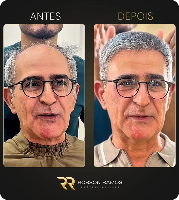 galeria-AD-45a65+-02